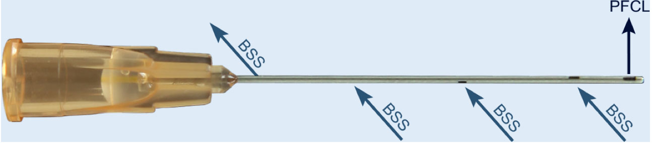 Figure 5.2.1 Dual bore cannula for injection of PFO. The venting sideports allow egression of BSS to reduce IOP during PFO injection.