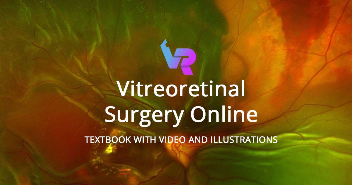 健康・医学 Vitreoretinal Surgery Amazon | Vitreoretinal Surgery | Saxena, Sandeep, Meyer